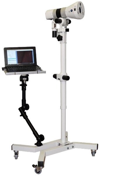 Видеокольпоскоп ВКС-01