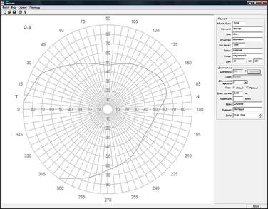 ПЕРИСКАН аппарат для полуавтоматической и компьютерной диагностики состояния полей зрения 