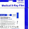 пленка для общей рентгенологии sfm bf синечувствительная, германия фото